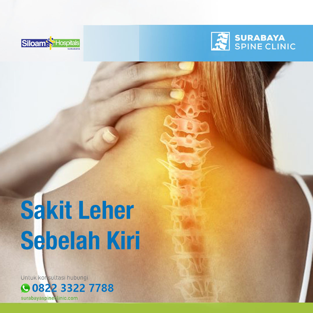 Memahami Sakit Leher Sebelah Kiri